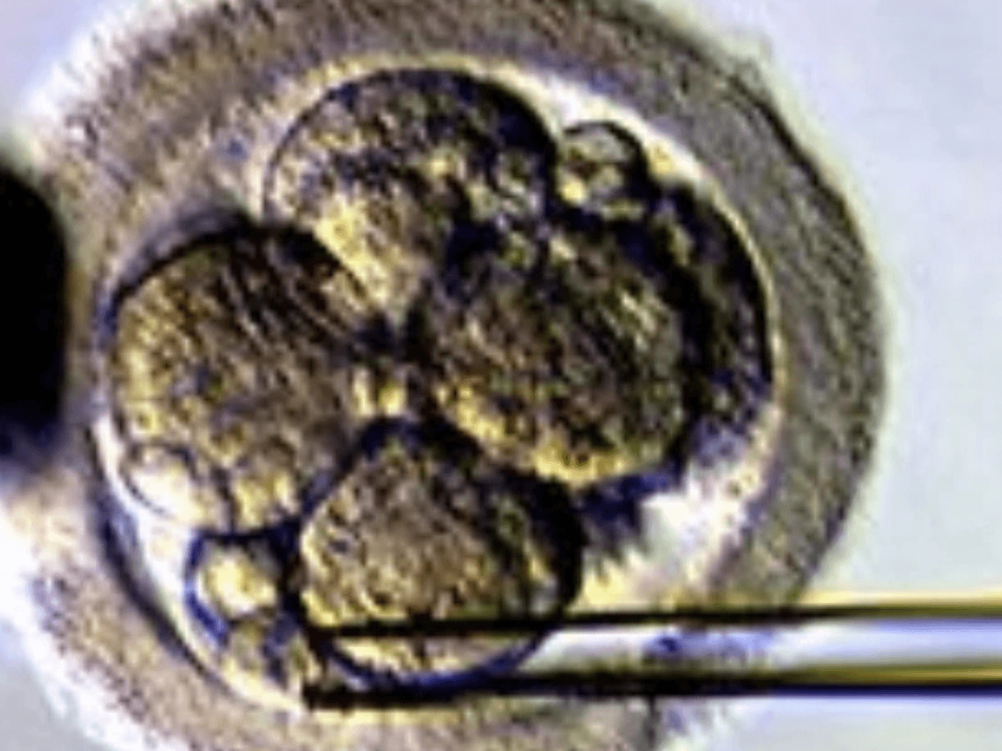 Técnica de assisted hatching
