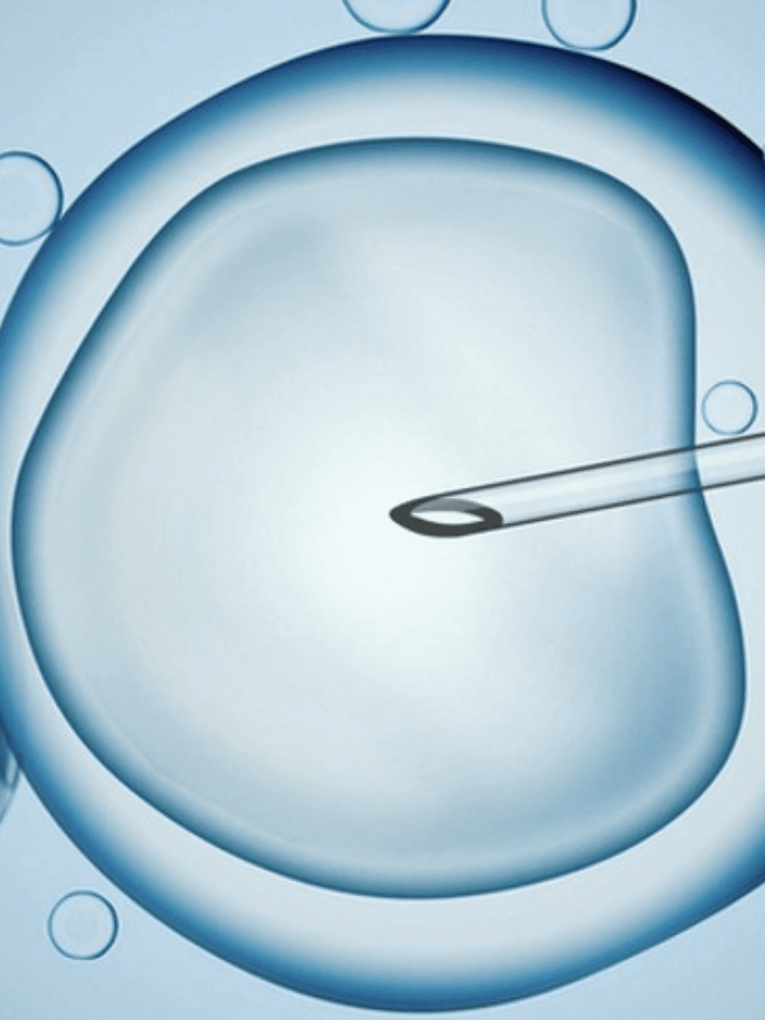 ICSI de Precisão sob microscópio
